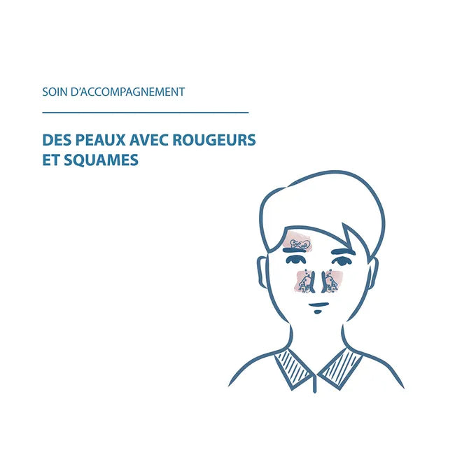 Ducray KELUAL DS - Crème Apaisante - Visage - Peaux Irritées avec Rougeurs et Squames, 40ml