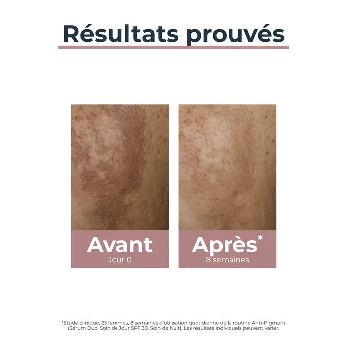 EUCERIN ANTI-PIGMENT - Soin de Jour SPF30 - Visage - Tous Types de Peaux, 50ml