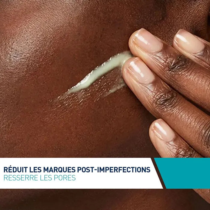 CeraVe Sérum Rétinol Anti-Marques - Peaux à Imperfections, 30ml